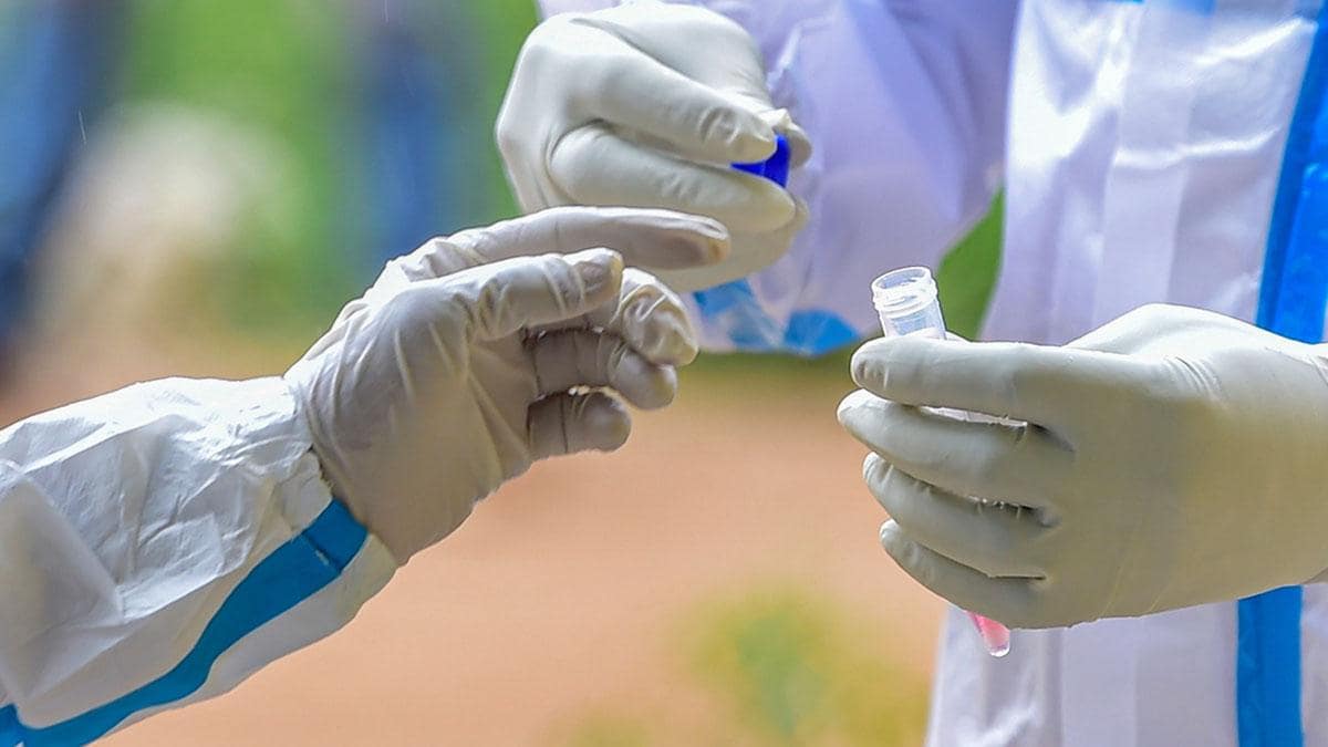 उत्तराखंड ब्रेकिंग: सस्ता हुआ कोरोना टेस्ट; रैपिड के बाद RT-PCR टेस्ट के रेट तय