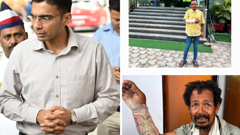 डीएम की करुणा और चिकित्सालय के सहयोग से असहाय राजू का जीवन सुरक्षित, जिला प्रशासन कर रहा पुनर्वास की योजना      