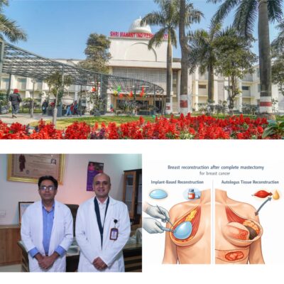 श्री महंत इन्दिरेश अस्पताल में पाँच घंटे चली जटिल सर्जरी में हुआ टोटल मैस्टेक्टमी विद ऑटोलॉगस होल ब्रेस्ट रिकंस्ट्रक्शन