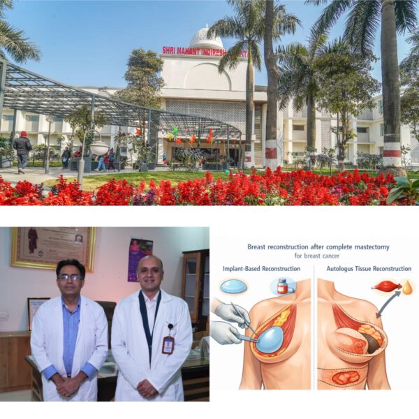 श्री महंत इन्दिरेश अस्पताल में पाँच घंटे चली जटिल सर्जरी में हुआ टोटल मैस्टेक्टमी विद ऑटोलॉगस होल ब्रेस्ट रिकंस्ट्रक्शन